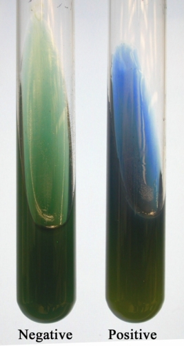 Simmons Citrat Agar
